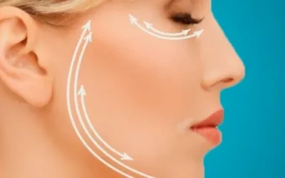 Endolifting: La Innovación en Rejuvenecimiento Facial Destaca en el GAEM BCN Congress
